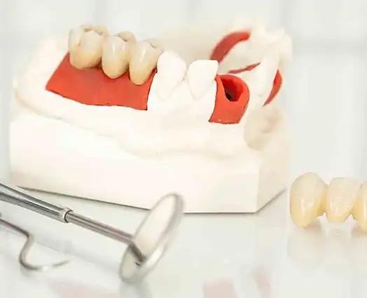 Dental Crowns Post-Operative Care